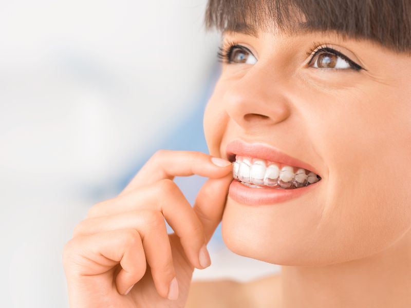 ortodoncia Invisalign