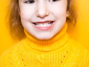 maloclusiones brackets metálicos