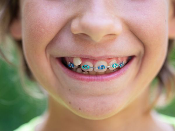 uso de brackets