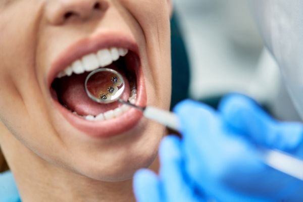 tipos de ortodoncia