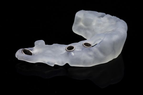 férulas dentales