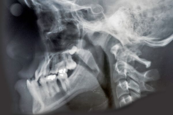 ortopedia dental en niños